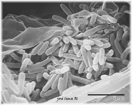 Το βακτηρίδιο της Xylella fastidiosa - Ν. Λυγερός